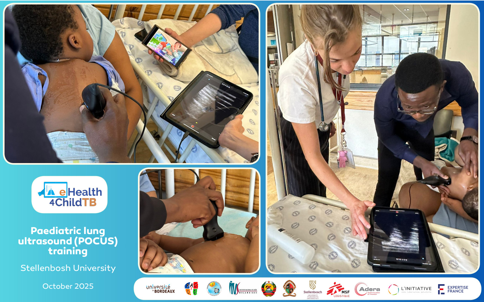 eH4CTB LinkedIn POCUS Training Stellenbosh Oct2025